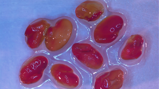 Tetrazolium Test for Legumes